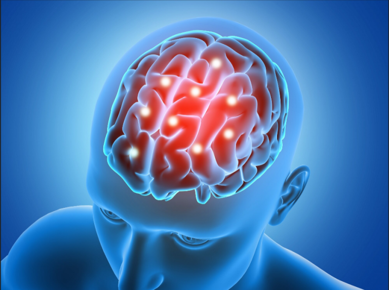 Rivaroxabán en tromboembolismo venoso cerebral