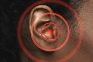 Antibióticos otitis media